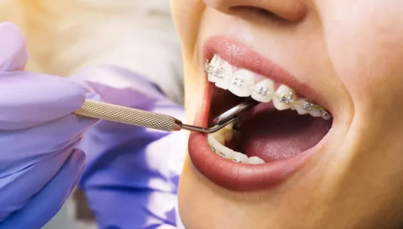 Orthodentiste à Fès : Transformez Votre Sourire avec Cabinet Debbagh Dental Smile