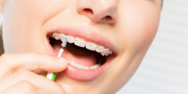 Sourire radieux après un traitement orthodontique à Fès. Le Dr. Saad Debbagh, orthodontiste expert, a transformé ce sourire avec soin et expertise. Des dents alignées et saines sont le résultat d'un traitement personnalisé dans notre clinique à Fès. Découvrez comment vous aussi pouvez retrouver la confiance et le bonheur à travers un sourire éclatant avec l'expertise de l'orthodontiste de renom, le Dr. Saad Debbagh, à Fès.