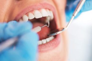 Orthodontiste à Fès : Conseils pour les soins dentaires