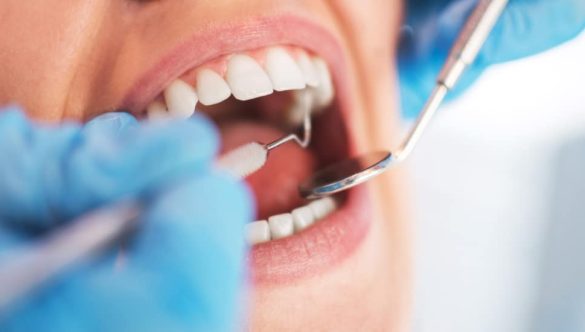 Orthodontiste à Fès : Conseils pour les soins dentaires